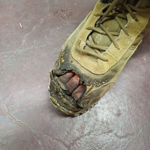 Verbrannte Zehen in Einsatzstiefel rechter Fuß