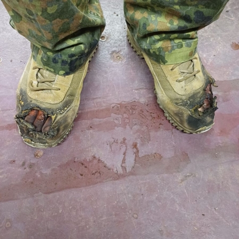 Verbranntes Stiefel Paar mit Brandverletzung Zehen