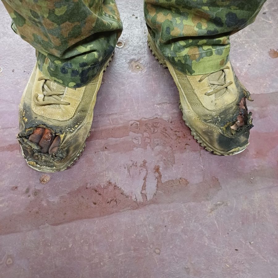 Verbranntes Stiefel Paar mit Brandverletzung Zehen