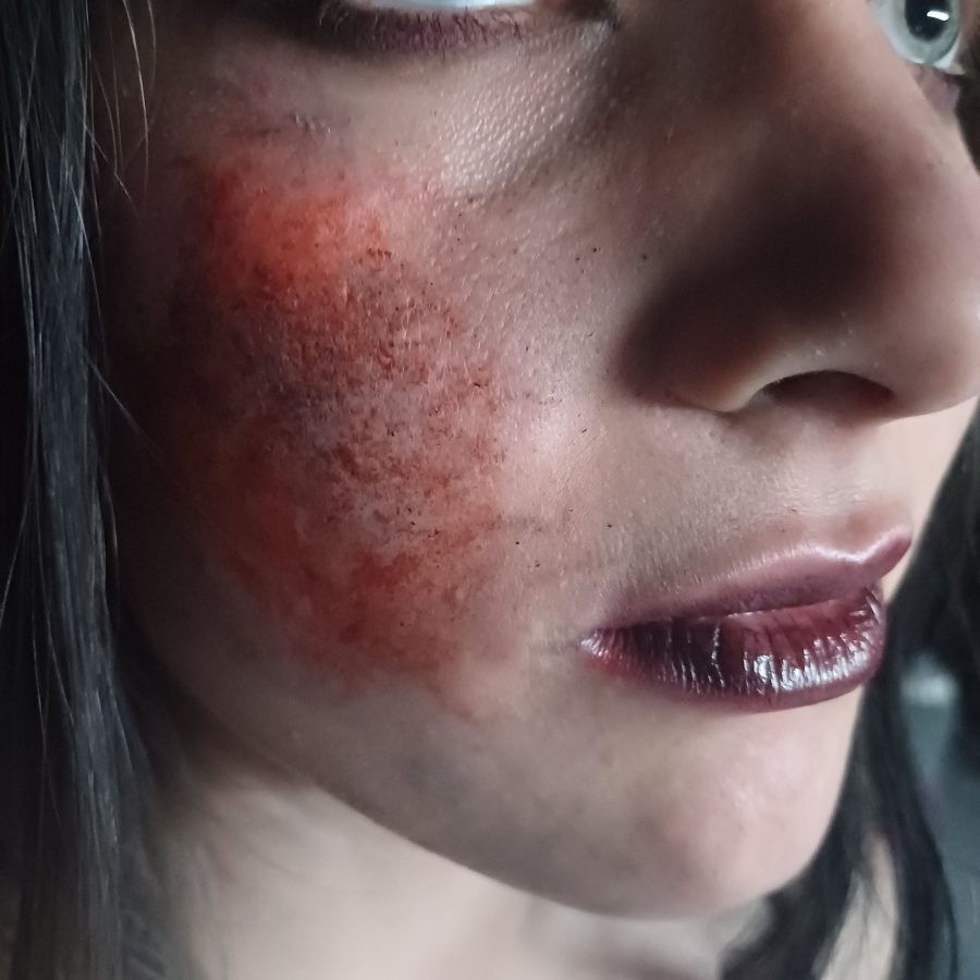 Dunkles Wesen abgerisse Backenhaut