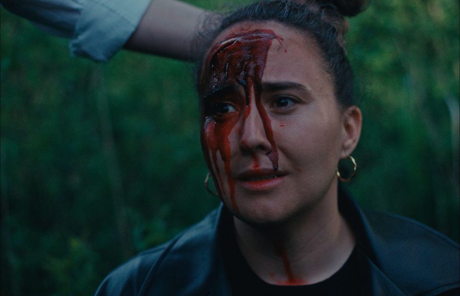 Kopfplatzwunde bei Welcome to Paradies