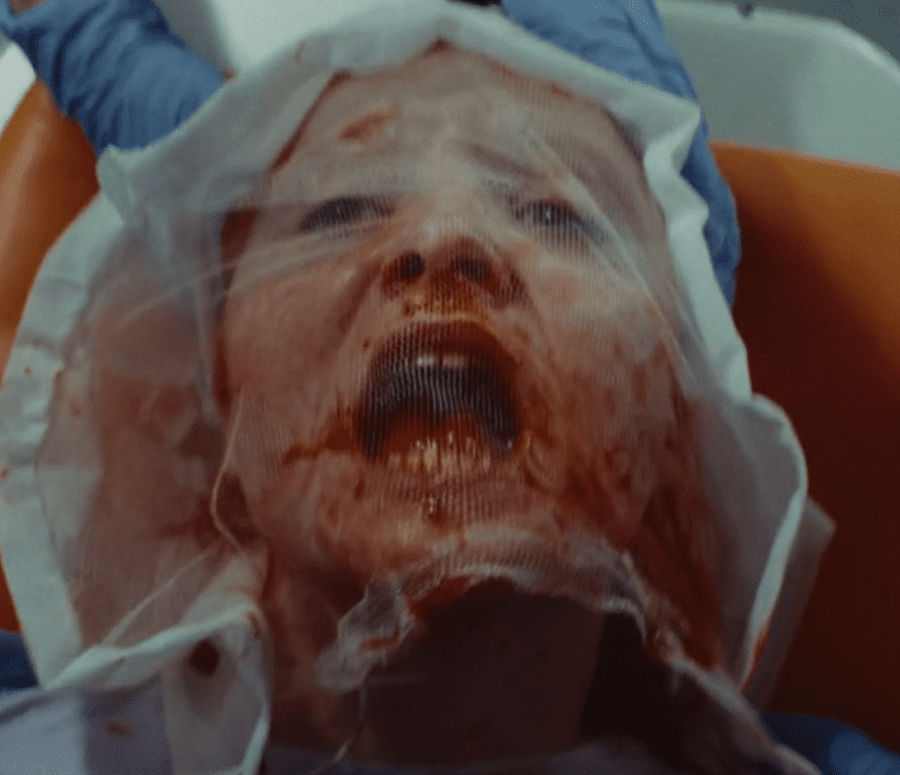 Blutspucken unter Schutzhaube Make Up SFX Trance